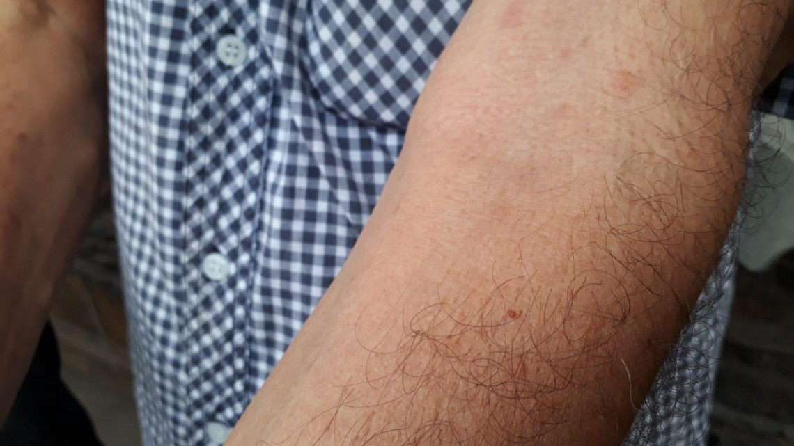 Denuncian escurrimientos de aguas negras en amplio sector poblacional