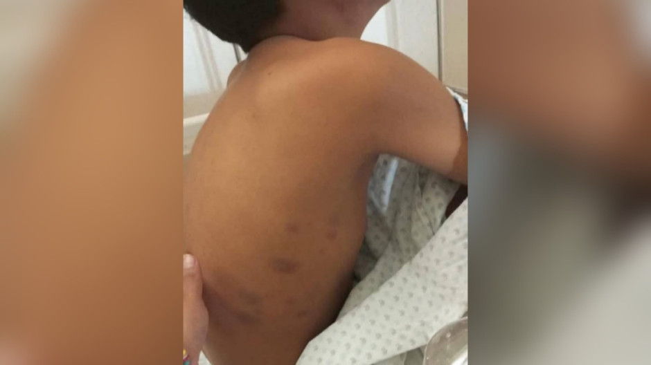 Niño de 11 años lucha por su vida en hospital sin atención especializada