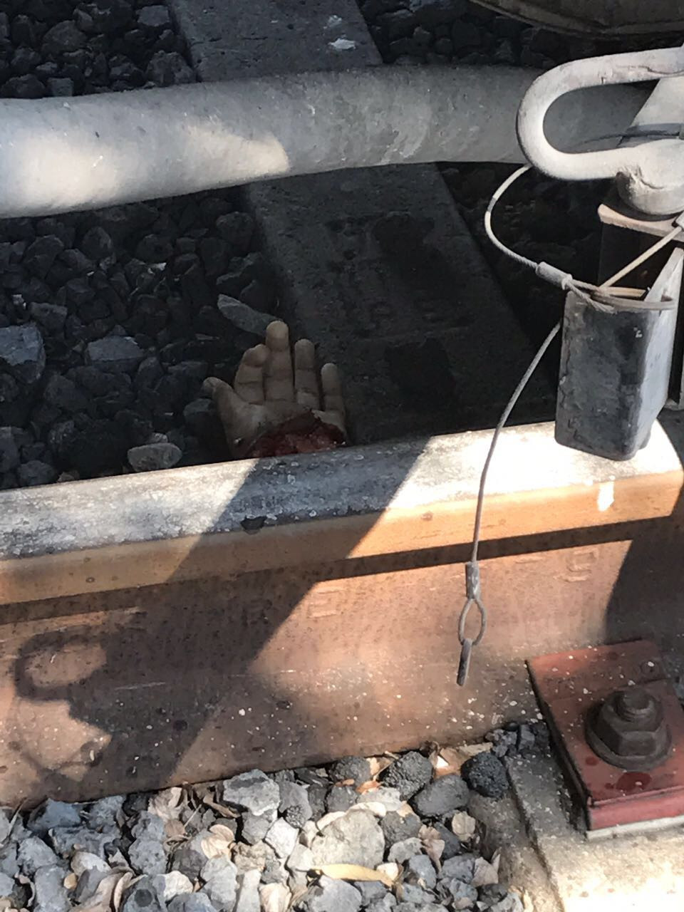 Tren le mutila brazo izquierdo a estudiante de Conalep