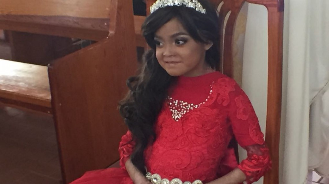 Dianita "la princesa mariposa" celebra sus 15 años