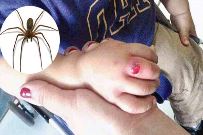 Sufre menor picadura de araña violinista