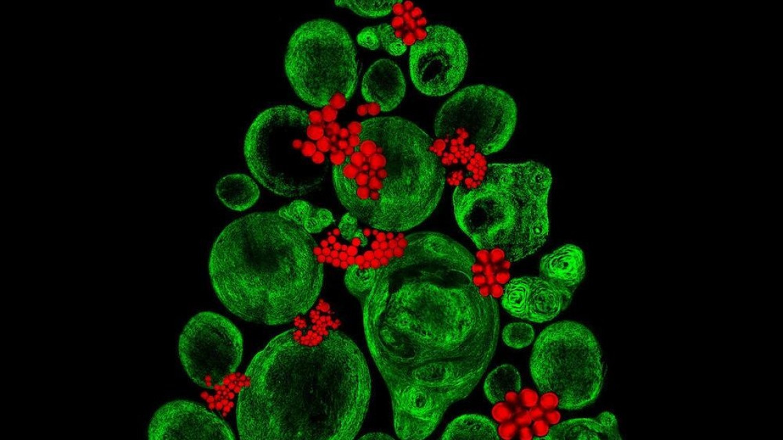 Estas microscópicas imágenes te sorprenderán