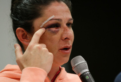 Juez ordena prisión al agresor de Ana Guevara