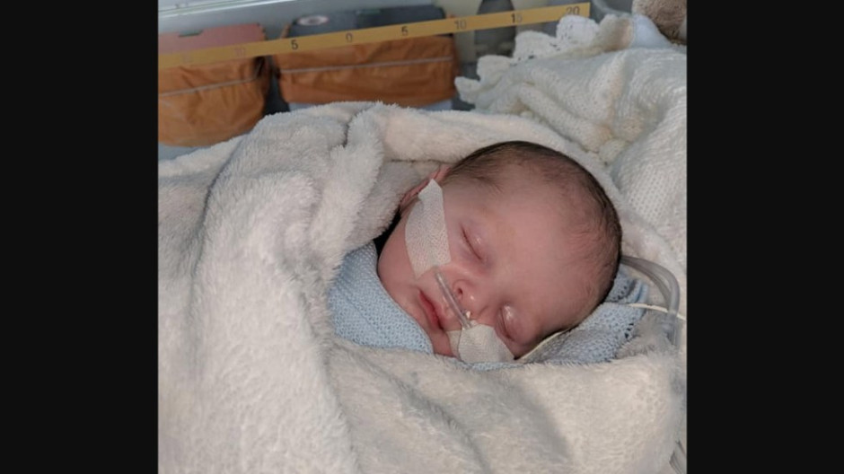 Bebé se enferma de herpes por un beso