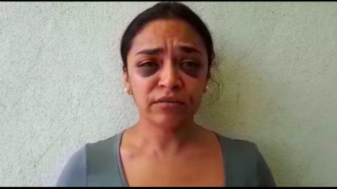 Periodista reporta agresión física por parte de policías tras denunciar intento de violación