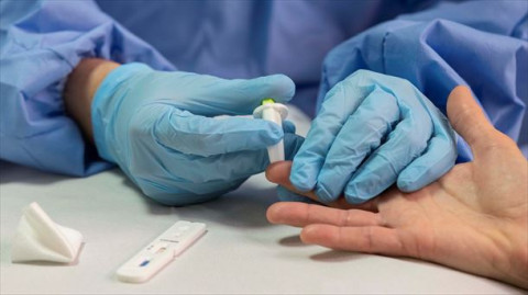 Confirma SST 247 casos de COVID-19 y 22 defunciones