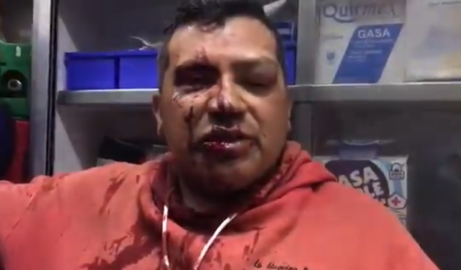 Dos periodistas atacados por elementos de la Secretaría de Seguridad