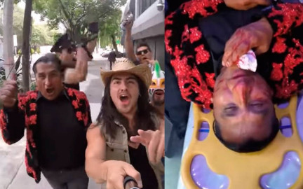 ¡Al hospital! Lady wuuu resulta con nariz rota tras broma