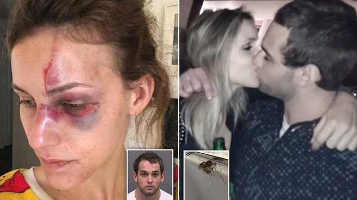 Publica las secuelas de la brutal golpiza que le da su novio