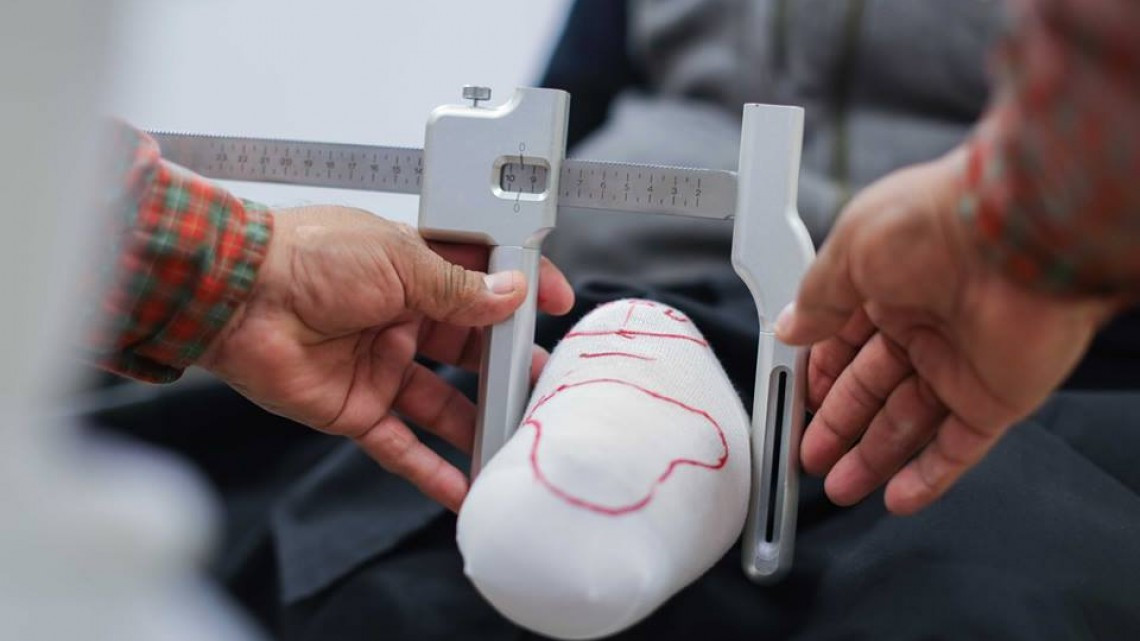 Personal del CREE recibe curso de certificación Ottobock