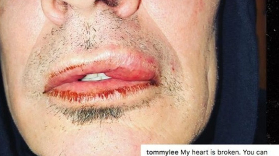 Tommy Lee es agredido por su hijo