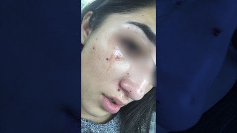 Destruye parabrisas de auto y es llamada #LadyPiñata