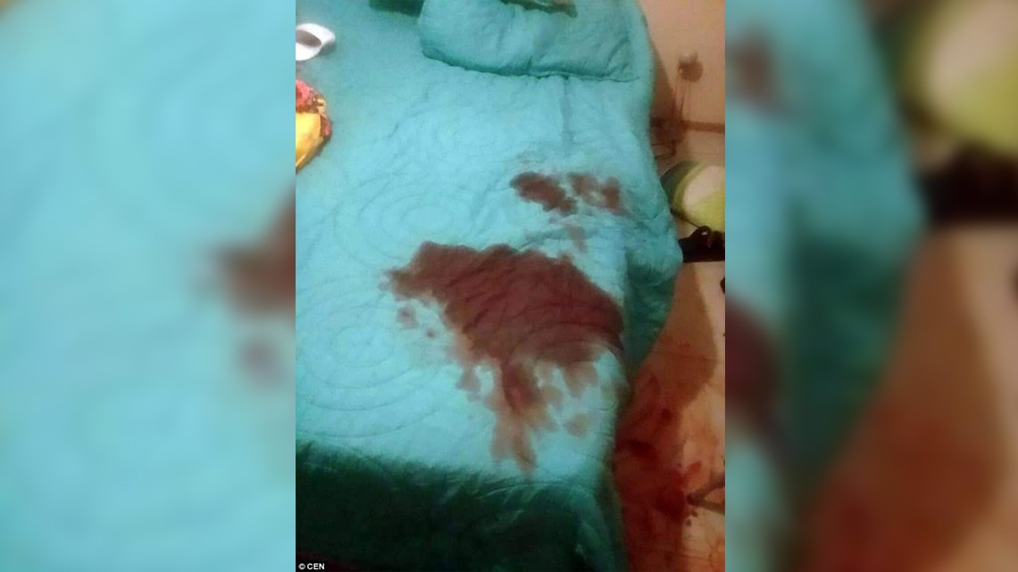 Mujer corta pene y testículos a su amante