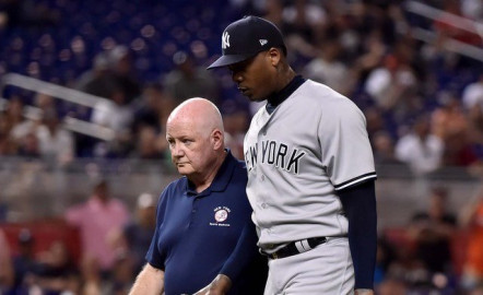 Aroldis Chapman fue colocado en la lista de lesionados de 10 días
