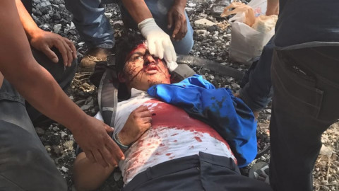 Tren le mutila brazo izquierdo a estudiante de Conalep