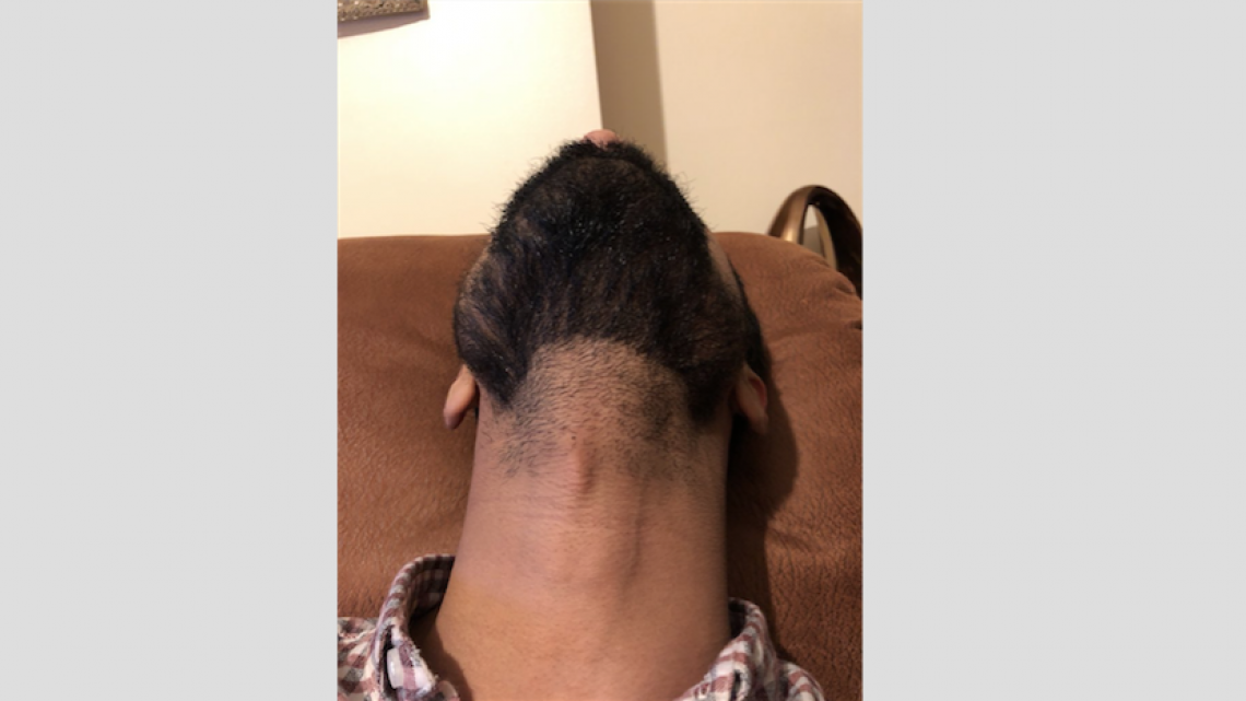 Perturbadoras imágenes de hombres barbudos mirando hacia arriba