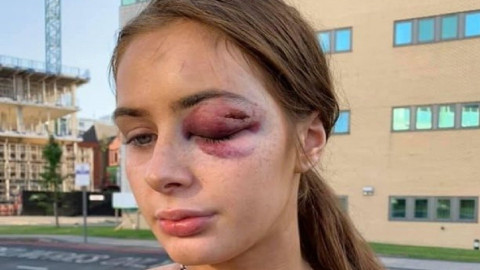 Mujer es agredida por rechazar a un hombre en la calle