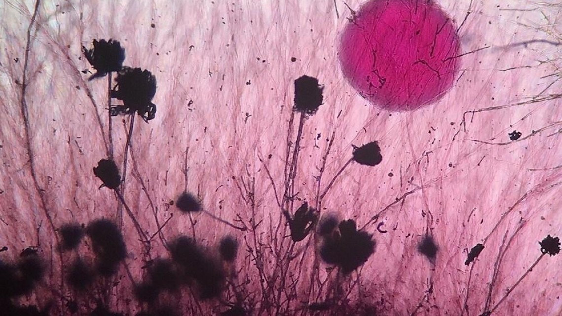 Estas microscópicas imágenes te sorprenderán