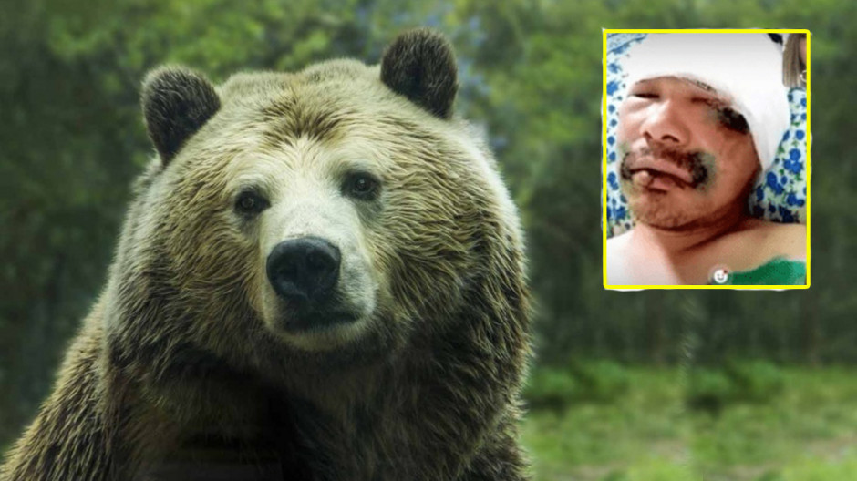 Hombre sobrevive a ataque de oso gracias a que le mordió la lengua