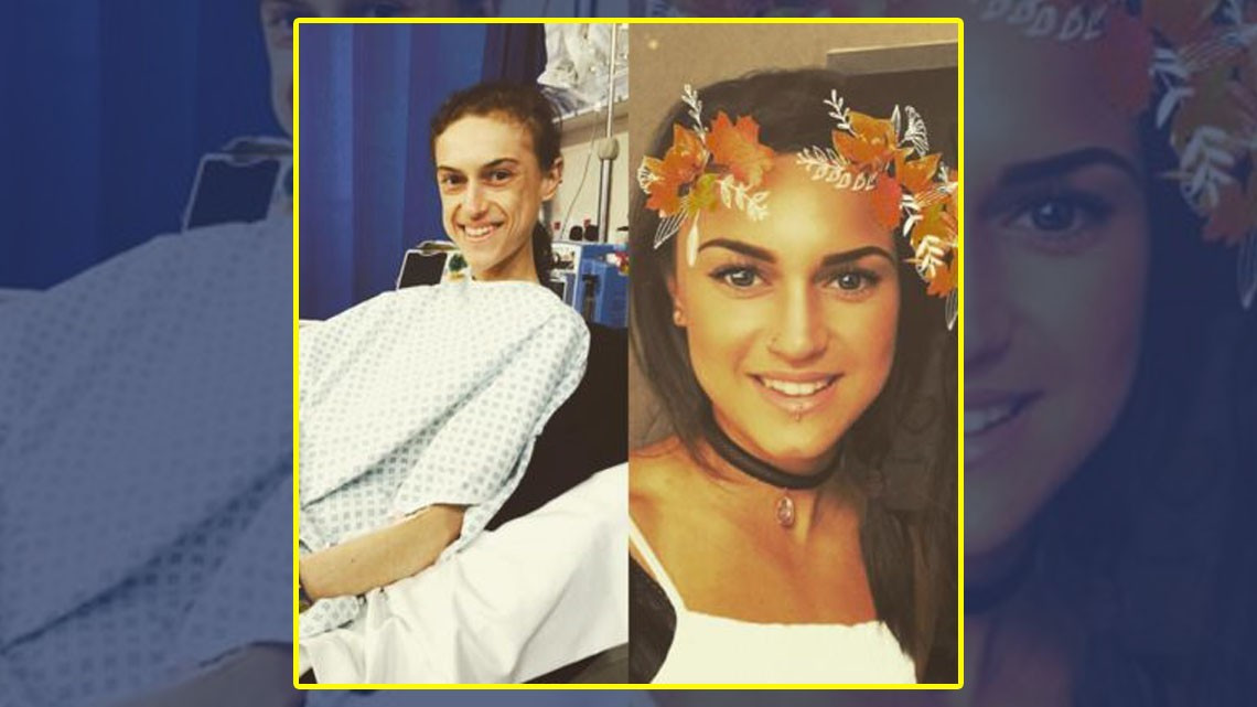 Chica muestra su recuperación tras anorexia