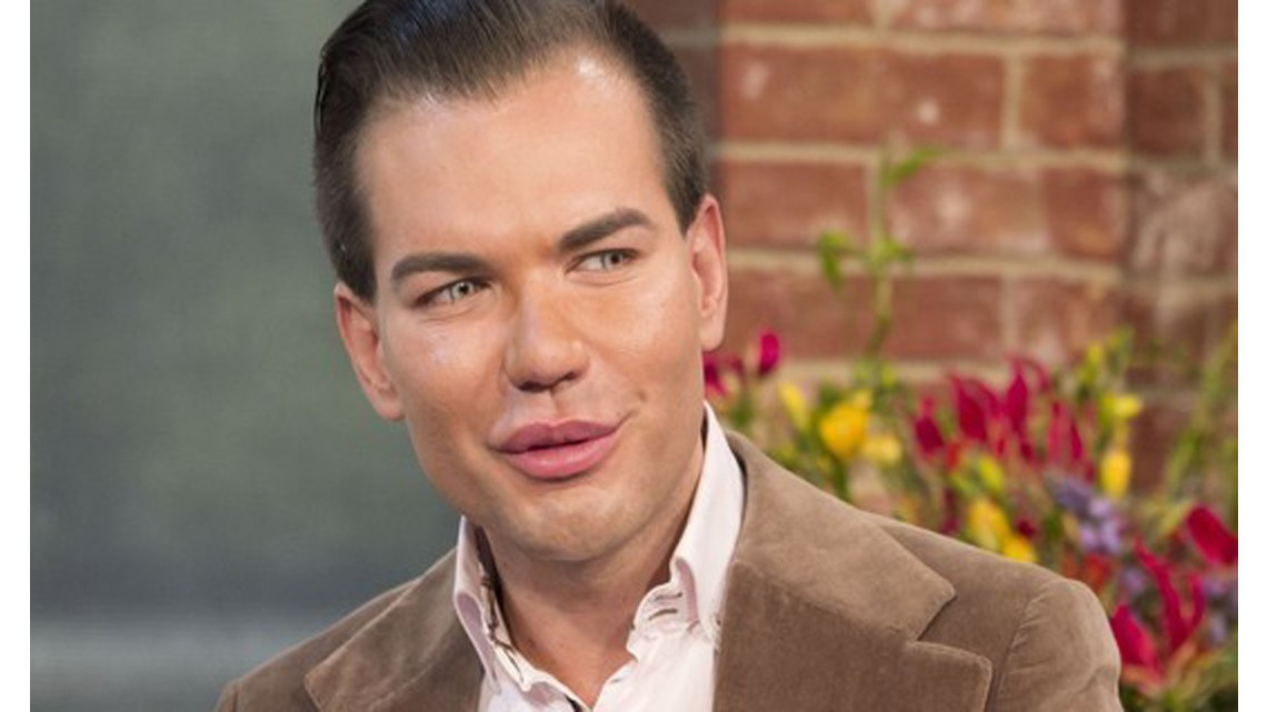 El "Ken humano" tiene complicaciones para respirar