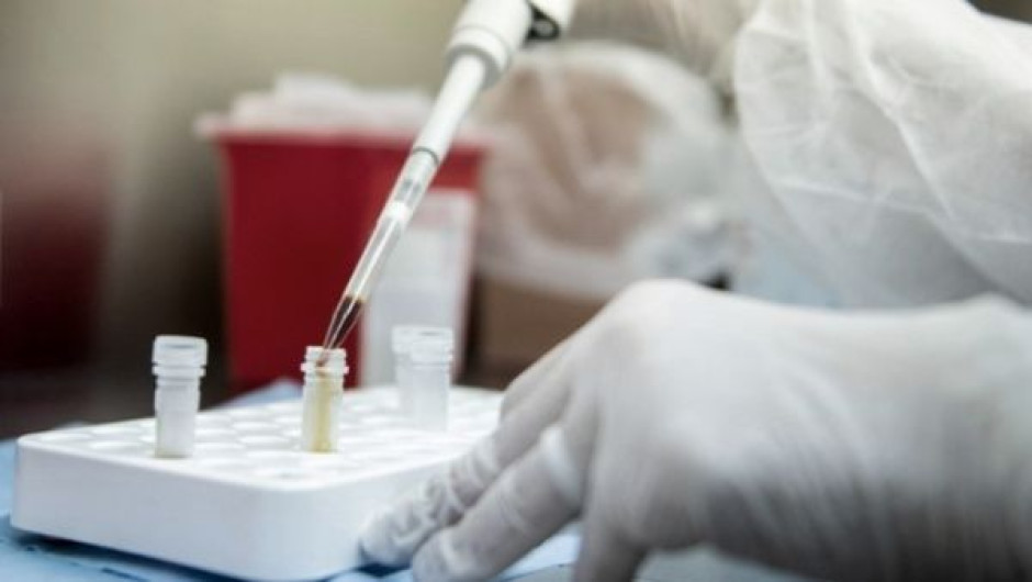 China aprueba la primera patente de su vacuna