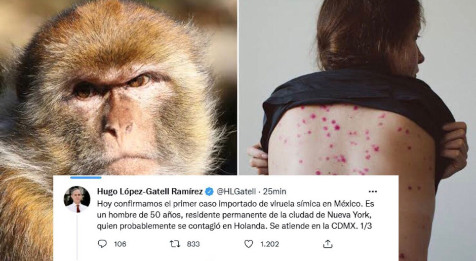 Confirma Hugo López-Gatell primer caso importado de viruela del mono en México