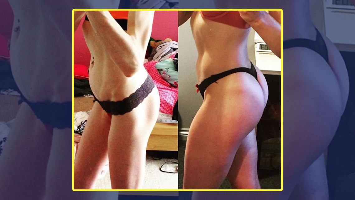 Chica muestra su recuperación tras anorexia