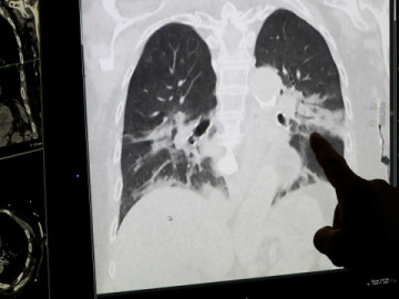 Tenemos mucho camino por delante: OMS