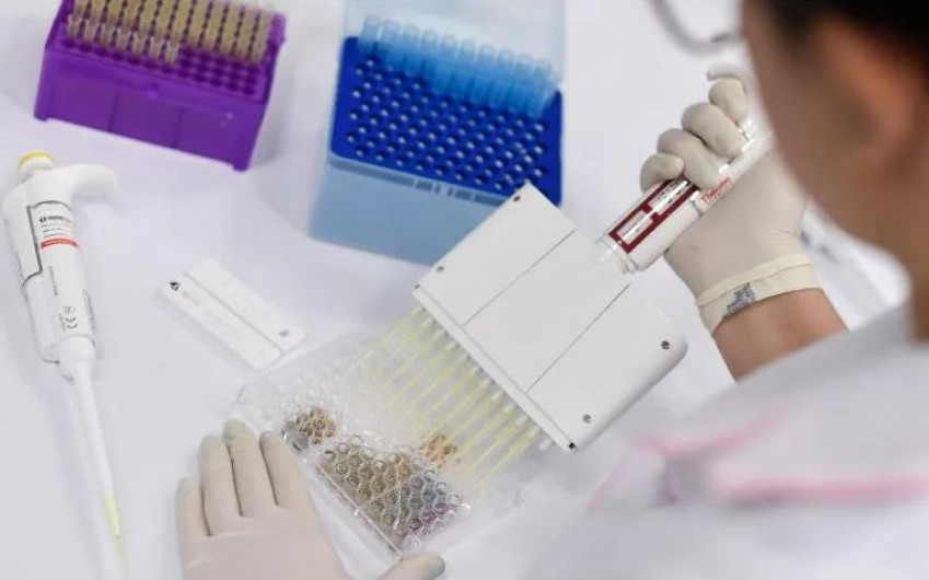 Pide ONU 35 mil mdd para acceso global a vacuna contra COVID-19