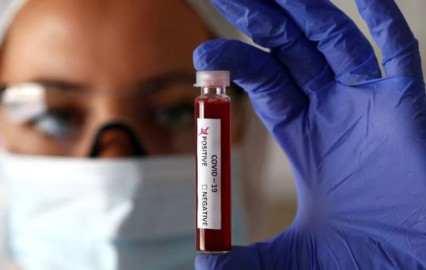 Confirman 2 nuevos casos de covid-19 en el Condado de Hidalgo; suman 190 en total