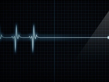 Esto sucede en el cerebro minutos antes de morir