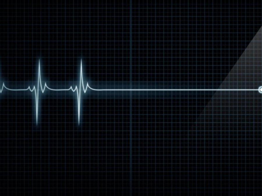 Esto sucede en el cerebro minutos antes de morir