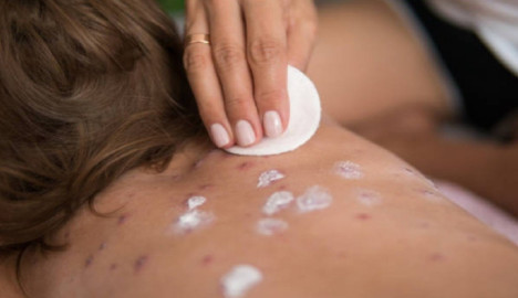 Ascienden a 19 casos confirmados de sarampión en México