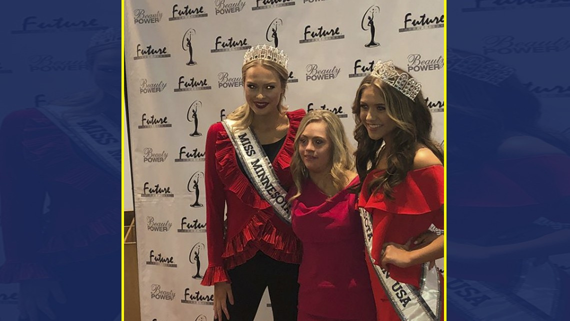 Mujer con Síndrome de Down compitió en Miss USA