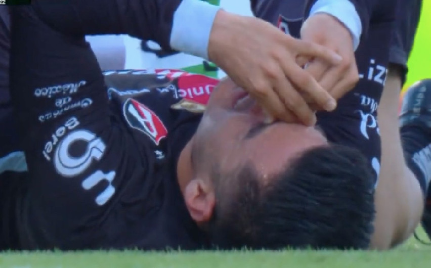 Aldo Rocha sufre lesión y podría perderse el Clásico Tapatío