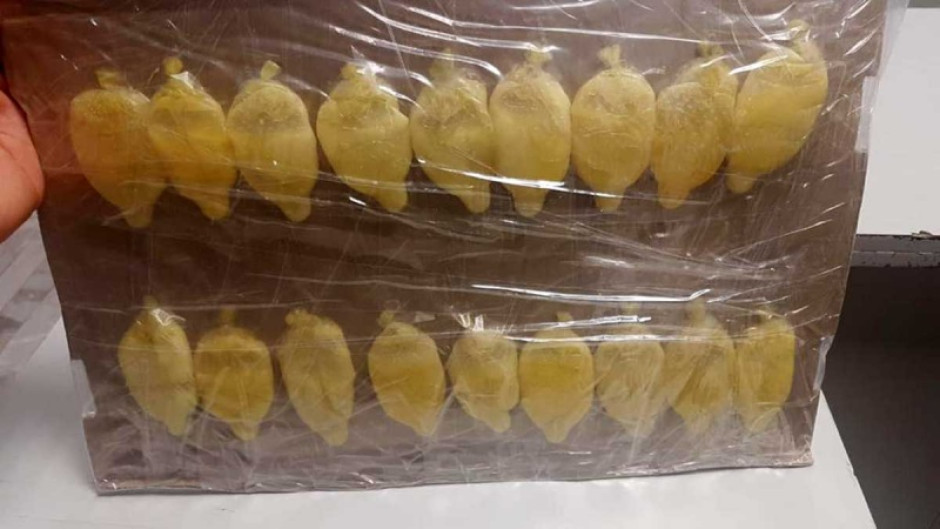 Extraen 40 bolsas de cocaína del estómago de una mujer 