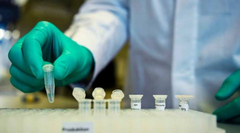 En Estados Unidos, pruebas de hidroxicloroquina en pacientes con COVID-19 obtiene resultados negativos