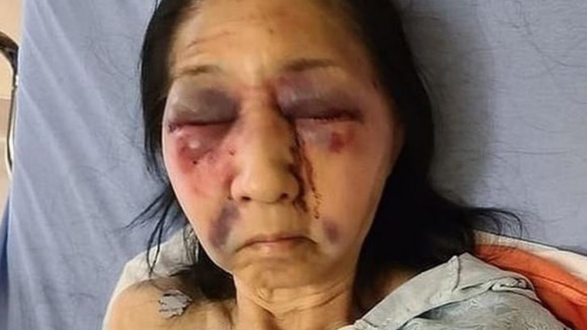 Mujer afroamericana golpea a mexicana por creer que era asiática 