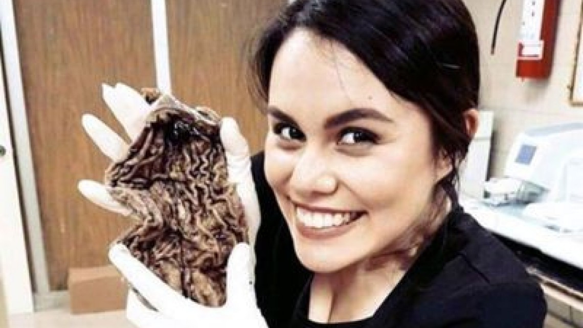 IMSS despide a residentes por tomarse fotos con un pie amputado 