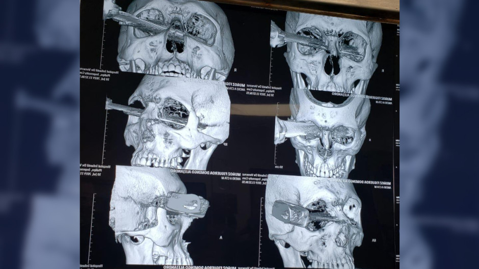 Acuchillado tras pelea en estacionamiento
