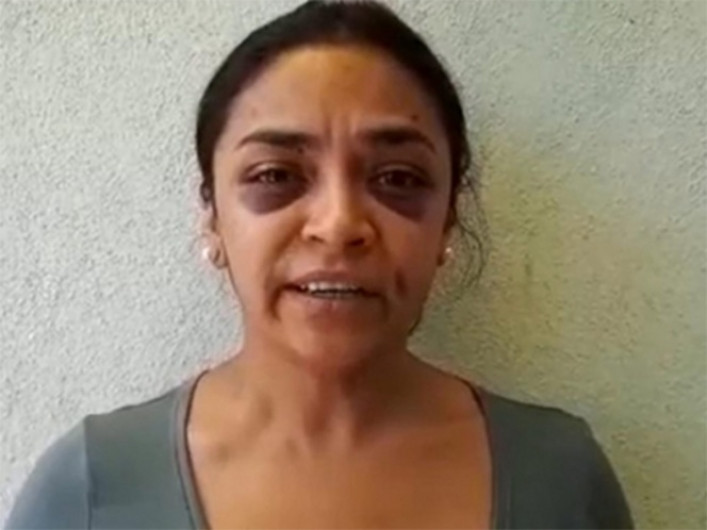 No hay pruebas de agresión a periodista: Seguridad de Morelia