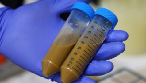 Trasplantes fecales, más efectivos de los que imaginabas