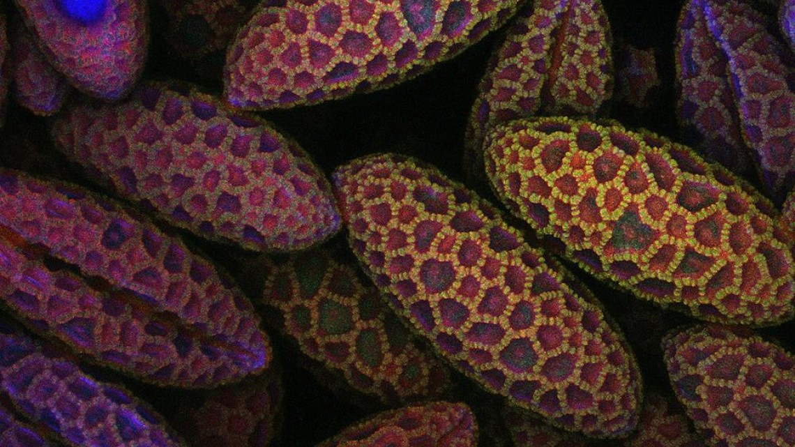 Estas microscópicas imágenes te sorprenderán