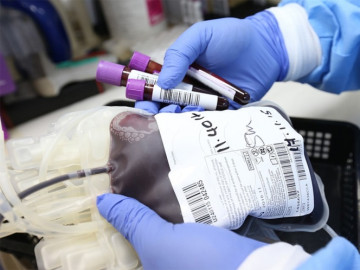 Pacientes asintomáticos muestran respuesta inmunitaria más débil: estudio