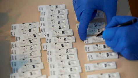 Aprueba EU uso de dos pruebas caseras para detectar covid-19