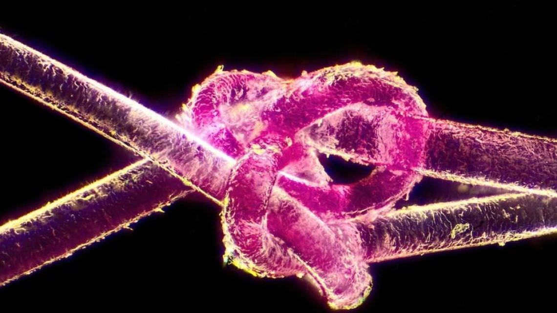 Estas microscópicas imágenes te sorprenderán