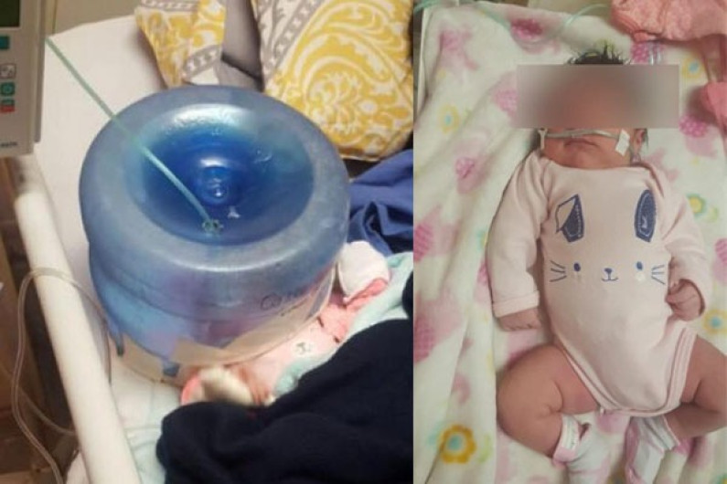 Hospital en Sonora usa garrafón como casco de oxígeno para bebé