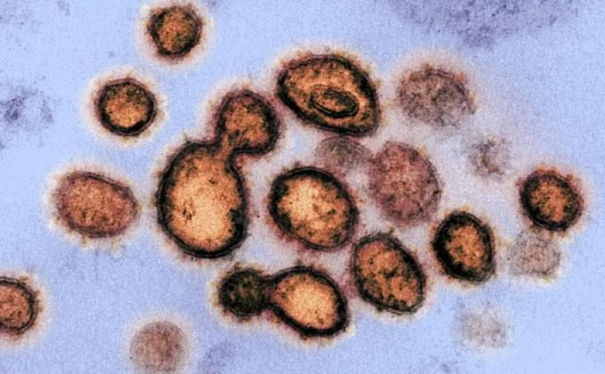 Investiga inDRE posible variación mexicana de SARS-CoV-2