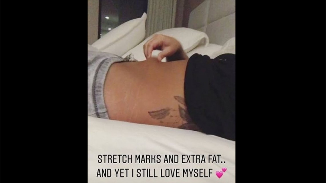 Demi Lovato muestra su celulitis a sus fans